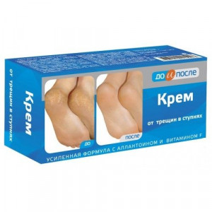 ДО И ПОСЛЕ КРЕМ Д/НОГ ОТ ТРЕЩИН В СТУПНЯХ 50МЛ. /ТВИНС ТЭК/ ДО И ПОСЛЕ КРЕМ Д/НОГ ОТ ТРЕЩИН В СТУПНЯХ 50МЛ. /ТВИНС ТЭК/